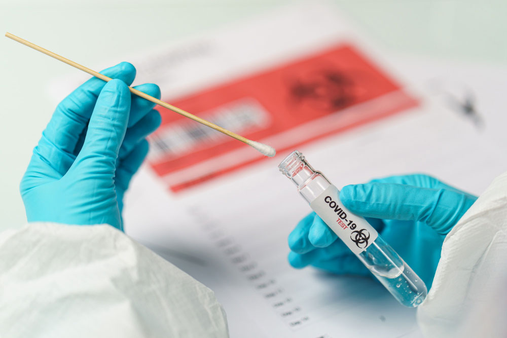 hand-holding-covid-19-swab-collection-kit-specimen-sample-testing-process